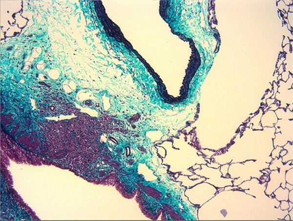 Elastin Masson trichrome: Combine Verhoeff-elastin and Masson trichrome to assess chronic damage in lung